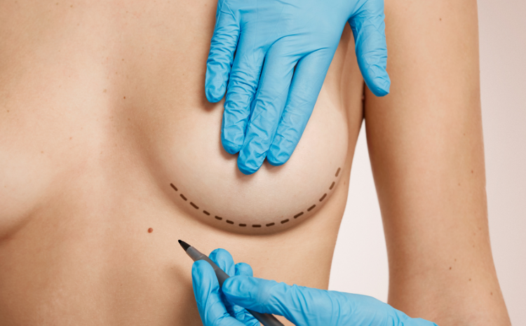 The Advantages Of Having Breast Reduction Surgery In Turkey Ic Estetİk